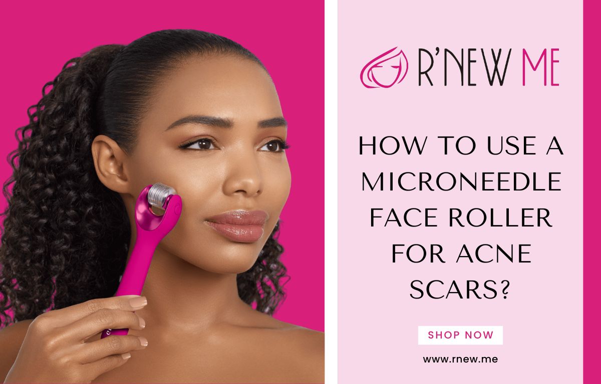How to Use a Microneedle Face Roller for Acne Scars?